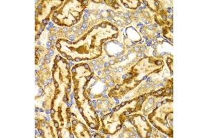 Immunohistochemistry of paraffin-embedded rat kidney using LAMP3 antibody (ABIN5971497) at dilution of 1/100 (40x lens). (LAMP3 Antikörper)