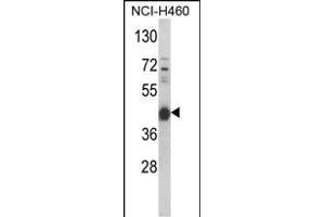 Western blot analysis of PRKACA Antibody (N-term K82) (ABIN390798 and ABIN2841043) in NCI- cell line lysates (35 μg/lane). (PRKACA Antikörper  (N-Term))