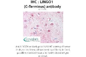 Image no. 1 for anti-Leucine Rich Repeat and Ig Domain Containing 1 (LINGO1) (C-Term) antibody (ABIN1736452) (LINGO1 Antikörper  (C-Term))