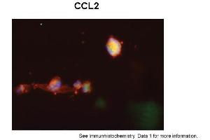 Sample Type: Human Macrophange CellsGreen: primaryRed: phallodinBlue: DAPIYellow: green/redPrimary Dilution: 1:200Secondary Antibody: anti-Rabbit IgG-FITCSecondary Dilution: 1:1000Image Submitted By: Milan FialaUniversity of California, Los Angeles (CCL2 Antikörper  (Middle Region))