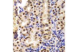Immunohistochemistry (Paraffin-embedded Sections) (IHC (p)) image for anti-X-Ray Repair Complementing Defective Repair in Chinese Hamster Cells 5 (Double-Strand-Break Rejoining) (XRCC5) (AA 543-732) antibody (ABIN6150309)