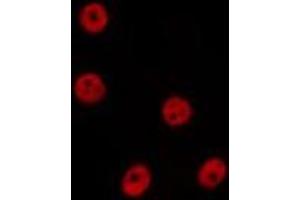 ABIN6277629 staining Hela by IF/ICC. (PRDM14 Antikörper  (N-Term))