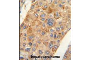 Immunohistochemistry (IHC) image for anti-Solute Carrier Family 35, Member G5 (SLC35G5) (AA 323-351), (C-Term) antibody (ABIN5539088)