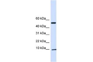 WB Suggested Anti-ATPIF1 Antibody Titration:  0. (ATPase Inhibitory Factor 1 Antikörper  (N-Term))
