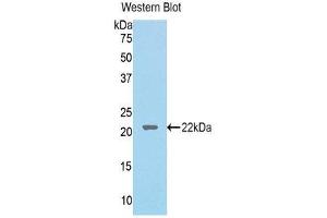 Western Blotting (WB) image for anti-Lecithin-Cholesterol Acyltransferase (LCAT) (AA 41-210) antibody (ABIN1176768)