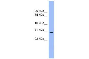 ENOPH1 antibody used at 1 ug/ml to detect target protein. (MASA Antikörper  (N-Term))