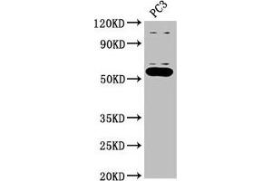 Western Blot Positive WB detected in: PC-3 whole cell lysate All lanes: OMA1 antibody at 2. (OMA1 Antikörper  (AA 22-194))
