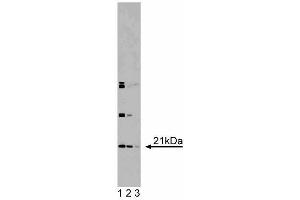 Western blot analysis of DHFR on RSV-3T3 lysate.