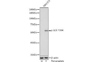 Western blot analysis of extracts of NIH/3T3 cells, using Phospho-LCK-Y394 antibody (ABIN3019739, ABIN3019740, ABIN3019741 and ABIN7101863) at 1:1000 dilution. (LCK Antikörper  (pTyr394))