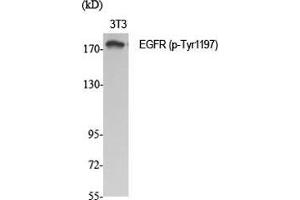 Western Blot (WB) analysis of specific cells using Phospho-EGFR (Y1197) Polyclonal Antibody.