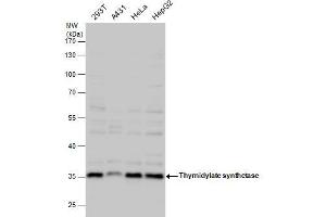 Western Blotting (WB) image for anti-Thymidylate Synthetase (TYMS) antibody (ABIN2855587)