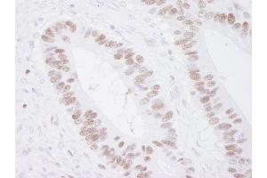Immunohistochemistry (IHC) image for anti-Minichromosome Maintenance Complex Component 3 (MCM3) (AA 500-550) antibody (ABIN7448652)