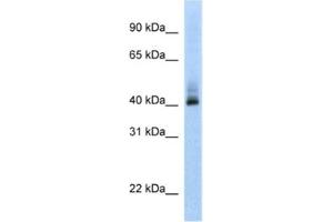 Western Blotting (WB) image for anti-Ankyrin Repeat Domain 42 (ANKRD42) antibody (ABIN2462361) (ANKRD42 Antikörper)