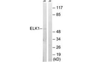 Western blot analysis of extracts from JurKat cells, using Elk1 (Ab-383) Antibody. (ELK1 Antikörper  (AA 351-400))