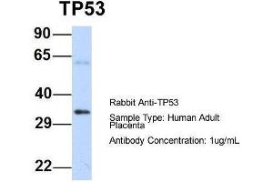 Host: Rabbit  Target Name: TP53  Sample Tissue: Human Adult Placenta  Antibody Dilution: 1. (p53 Antikörper  (N-Term))