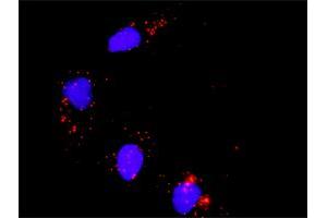 Proximity Ligation Analysis of protein-protein interactions between MAPK3 and ATF2. (ATF2 Antikörper  (AA 91-190))