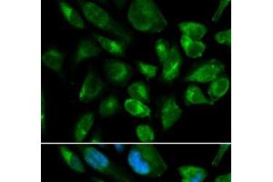 Immunofluorescence analysis of HepG2 cells using KIR2DL3 Polyclonal Antibody (KIR2DL3 Antikörper)