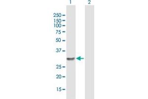 Western Blot analysis of LOC150786 expression in transfected 293T cell line by LOC150786 MaxPab polyclonal antibody. (WTH3DI Antikörper  (AA 1-254))