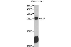 Western blot analysis of extracts of mouse heart, using NGF antibody (ABIN6293296) at 1:1000 dilution. (Nerve Growth Factor Antikörper)