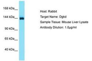 Image no. 1 for anti-Diacylglycerol Kinase, delta 130kDa (DGKD) (AA 449-498) antibody (ABIN6750521) (DGKD Antikörper  (AA 449-498))