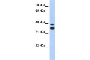 WB Suggested Anti-MSX2 Antibody Titration: 0.