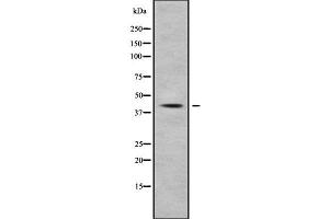Western blot analysis NFKBIL1 using HepG2 whole cell lysates (NFKBIL1 Antikörper  (Internal Region))