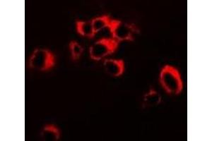 Immunofluorescent analysis of RNF81 staining in SW620 cells. (TRIM21 Antikörper)