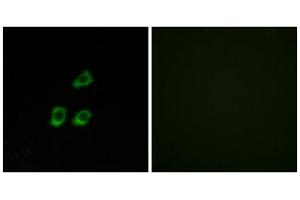 Immunofluorescence analysis of HUVEC cells, using CLCN4 antibody. (CLCN4 Antikörper  (Internal Region))