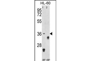Western blot analysis of anti-TNFRSF14 Antibody (Center) Pab (ABIN653038 and ABIN2842652) pre-incubated without(lane 1) and with(lane 2) blocking peptide in HL-60 cell line lysate. (HVEM Antikörper  (AA 210-236))