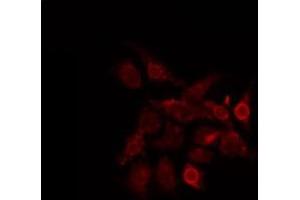 ABIN6274033 staining HepG2 by IF/ICC.