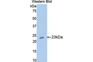 Western blot analysis of the recombinant protein. (COMP Antikörper  (AA 235-423))