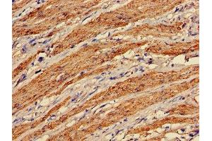 Immunohistochemistry of paraffin-embedded human smooth muscle tissue using ABIN7172847 at dilution of 1:100 (Transgelin Antikörper  (AA 2-201))
