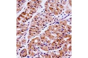 Immunohistochemistry analysis in formalin fixed and paraffin embedded human stomach tissue reacted with KLK15 / Kallikrein-15 Antibody (Center) followed by peroxidase conjugation of the secondary antibody and DAB staining. (Kallikrein 15 Antikörper  (Middle Region))