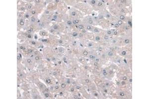 DAB staining on IHC-P; Samples: Human Liver Tissue (APOA1 Antikörper  (AA 122-267))
