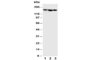 Western blot testing of Collagen IV antibody and Lane 1:  MCF-7