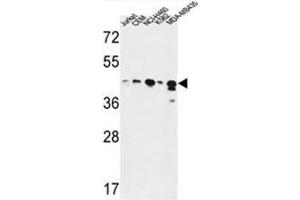 ADH7 Antibody (C-Term) western blot analysis in Jurkat,CEM,NCI-H460,K562,MDA-MB435 cell line lysates (35µg/lane).