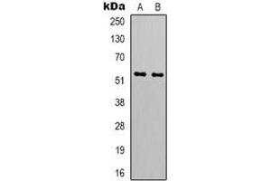 Western blot analysis of GIP Receptor expression in HT1080 (A), A549 (B) whole cell lysates.