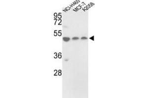 Western Blotting (WB) image for anti-Protein Disulfide Isomerase Family A, Member 6 (PDIA6) antibody (ABIN3002738) (PDIA6 Antikörper)