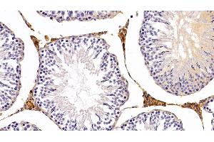Immunohistochemistry (IHC) image for anti-Leptin (LEP) (AA 22-167) antibody (ABIN7429181)