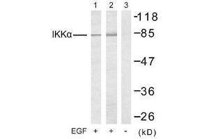 Western blot analysis of extracts from 293 cells (Lane 1) and MDA-MB-435 cells (Lane 2 and 3), untreated or treated with EGF, using IKKα (Ab-23) antibody (E021123). (IKK alpha Antikörper)