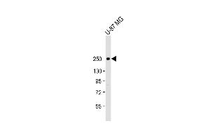 SCN1A Antikörper  (AA 481-515)