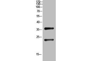 Western Blot analysis of customer's (cat sample) using QM Polyclonal Antibody. (PRL3D1 Antikörper  (N-Term))
