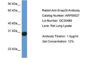 Western Blotting (WB) image for anti-Synaptosomal-Associated Protein, 29kDa (SNAP29) (Middle Region) antibody (ABIN2788104) (SNAP29 Antikörper  (Middle Region))
