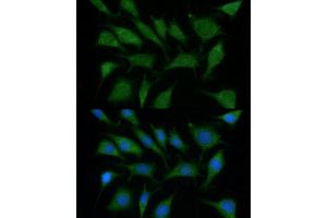 Immunofluorescence analysis of L929 using TRIM45 antibody (ABIN6132737, ABIN6149529, ABIN6149530 and ABIN6216483) at dilution of 1:100 (40x lens). (TRIM45 Antikörper  (AA 100-400))