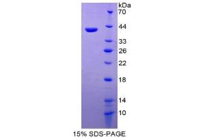 SDS-PAGE (SDS) image for Chemokine (C-C Motif) Ligand 26 (CCL26) (AA 24-94) protein (His tag,GST tag) (ABIN1981059)