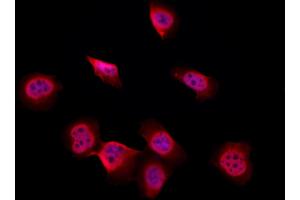 ABIN6265102 and ABIN6277278 staining Hela by IF/ICC. (SKP1 Antikörper  (Internal Region))