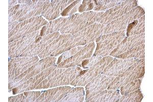 Immunohistochemistry (IHC) image for anti-Malonyl CoA Decarboxylase (MLYCD) antibody (ABIN2856728)