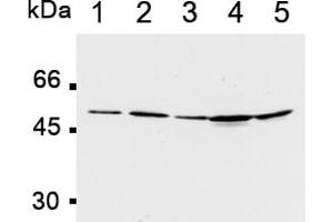 Western Blotting (WB) image for anti-Polymerase (DNA Directed), delta 2, Accessory Subunit (POLD2) antibody (ABIN567777) (POLD2 Antikörper)