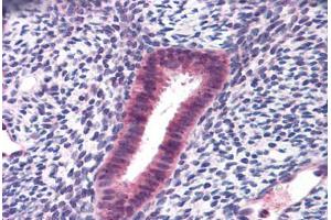 Human Uterus: Formalin-Fixed, Paraffin-Embedded (FFPE) (FOXN1 Antikörper  (AA 585-648))