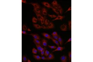 Immunofluorescence analysis of A-549 cells using Bcl-2 antibody (ABIN7265813) at dilution of 1:250. (Bcl-2 Antikörper  (AA 1-100))